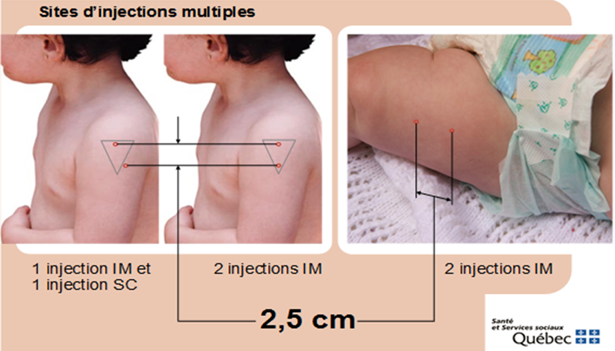 L'image présente deux jeunes enfants recevant chacun 2 injections dans le même bras ou dans la même cuisse